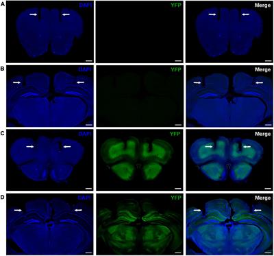 Inhibition of 14-3-3 Proteins Alters Neural Oscillations in Mice